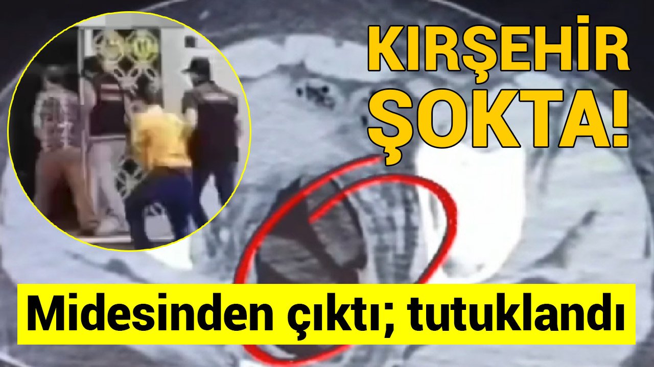 Kırşehir’de 2 kişinin midesinden çıkanlar şok etti: Tutuklandılar