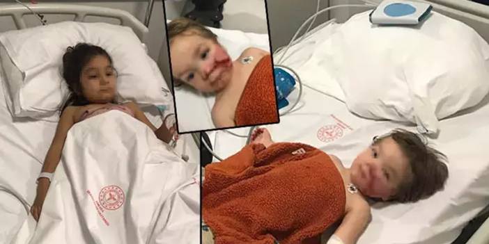 Ankara’da iki kardeşe saldıran 'pitbull'un sahibi 12 kez şikayet edilmiş