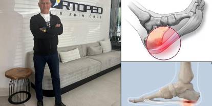 Topuk Dikeni: Sessizce Hayatı Kısıtlayan Bir Ayak Sorunu